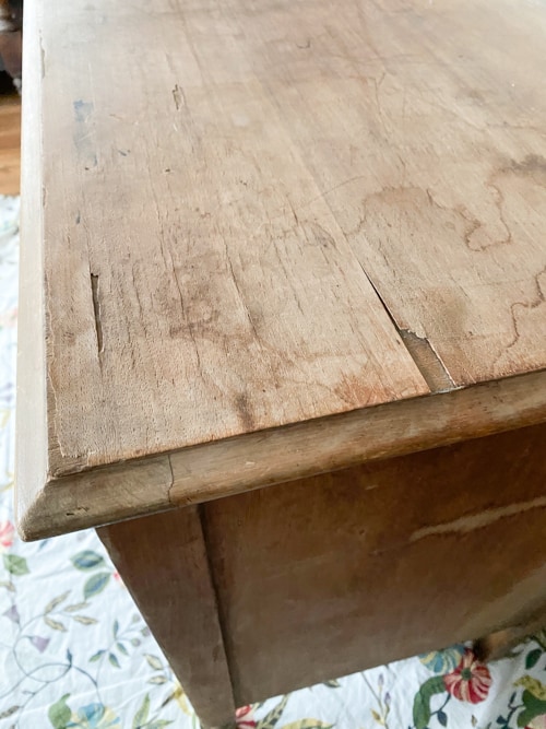 missing veneer